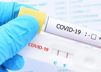 Ελέγχους ταχείας ανίχνευσης αντιγόνου Covid-19 (rapid tests) θα πραγματοποιήσουν αύριο