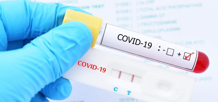 Ελέγχους ταχείας ανίχνευσης αντιγόνου Covid-19 (rapid tests) θα πραγματοποιήσουν αύριο