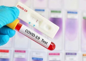 Πιερία: ΕΟΔΥ – Πού θα πραγματοποιηθούν Rapid Test σήμερα, Παρασκευή 28/1