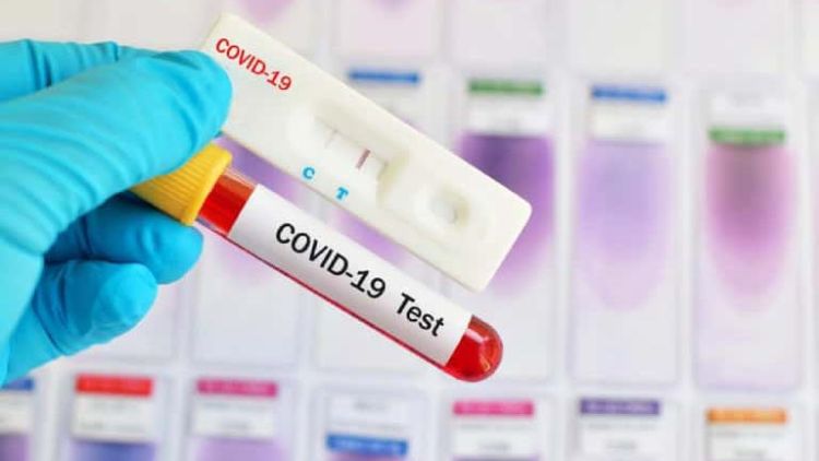 Πιερία: ΕΟΔΥ – Πού θα γίνονται σήμερα δωρεάν Rapid Test σήμερα, Πέμπτη 24/2