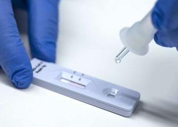 Κατερίνη – Πιερία: Σημεία Rapid Test για σήμερα, Παρασκευή 29/4