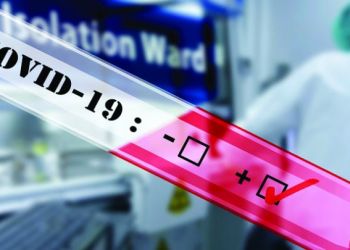 Κατερίνη – Πιερία: Σημεία Rapid Test για σήμερα, Κυριακή 22/5