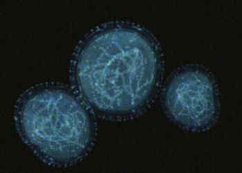 Ευλογιά των πιθήκων: Δεύτερο κρούσμα στην Ελλάδα μέσα σε τρεις ημέρες – Γιατί οι επιστήμονες φοβούνται μεγάλη αύξηση