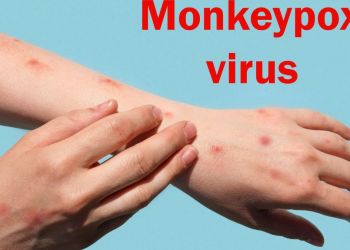 Ευλογιά των πιθήκων: Γιατί ο ΠΟΥ αποφάσισε να κηρύξει παγκόσμιο συναγερμό