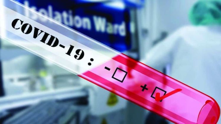 Κατερίνη – Πιερία: Σημεία Rapid Test για σήμερα, Δευτέρα 11/7