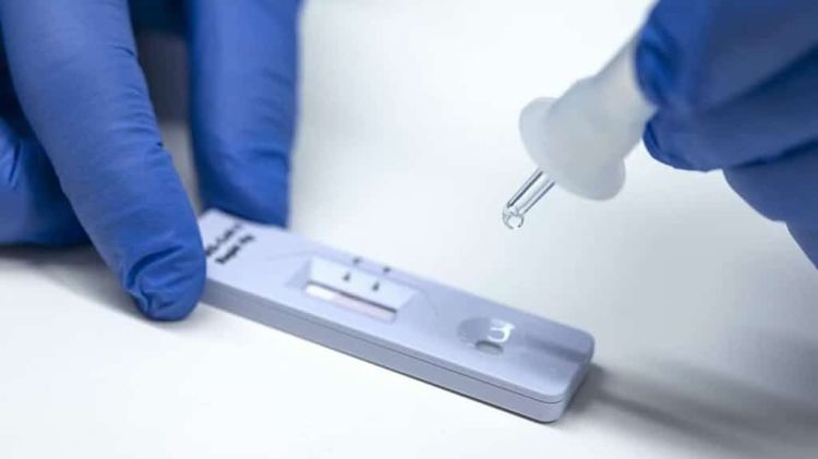 Κατερίνη – Πιερία: Σημεία Rapid Test για σήμερα Σάββατο 3/9