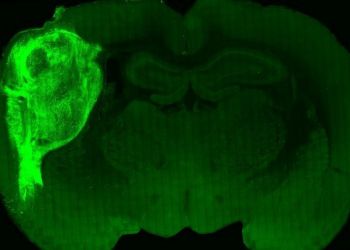 Ο πρώτος υβριδικός εγκέφαλος αρουραίου με λειτουργικούς ανθρώπινους νευρώνες