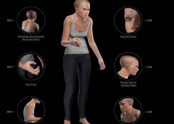 «Μίντι»: Oι άνθρωποι το 3.000 μ.Χ – Καμπουριασμένοι με διπλά βλέφαρα