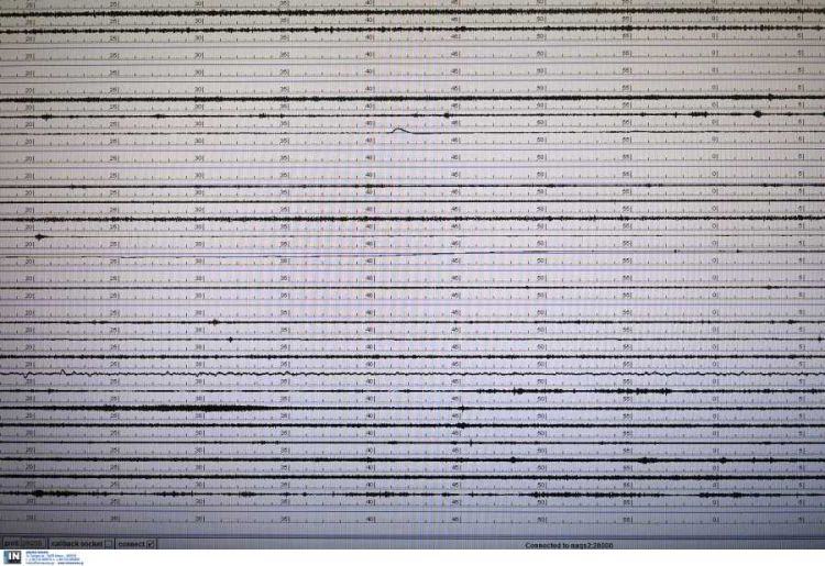 Πως λειτουργεί η ειδοποίηση της Google όταν κάνει σεισμό Πως λειτουργεί η ειδοποίηση της Google όταν κάνει σεισμό