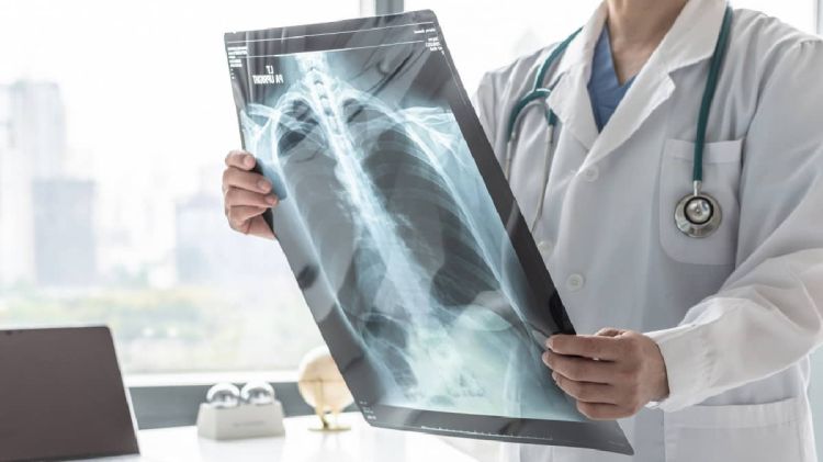 ΧΑΠ: 600.000 οι πάσχοντες στην Ελλάδα – Οι μισοί από αυτούς δεν το γνωρίζουν