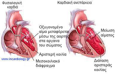Σε µάστιγα έχει εξελιχθεί η καρδιακή ανεπάρκεια