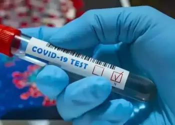 Σημεία rapid test στην Κατερίνη και την Πιερία για σήμερα Τρίτη 21/11