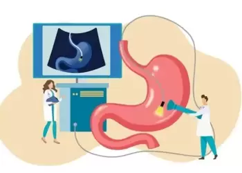 Η γαστροοισοφαγική παλινδρόμηση ταλαιπωρεί το 38% των Ελλήνων