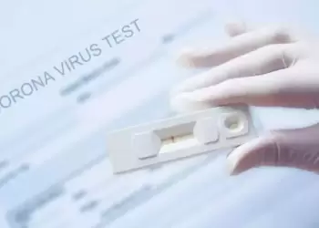 Σημεία rapid test στην Κατερίνη και την Πιερία για σήμερα Δευτέρα 11/12