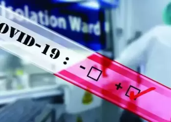 Rapid tests στην Κατερίνη και την Πιερία για σήμερα Δευτέρα 26/2