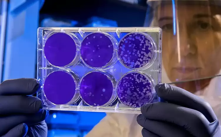 Tι είναι η οξεία βακτηριακή λοίμωξη που σκότωσε την Ντέμη Γεωργίου