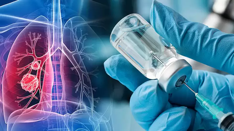 Ιστορική εξέλιξη: Αρχισαν οι δοκιμές εμβολίου για τον καρκίνο του πνεύμονα