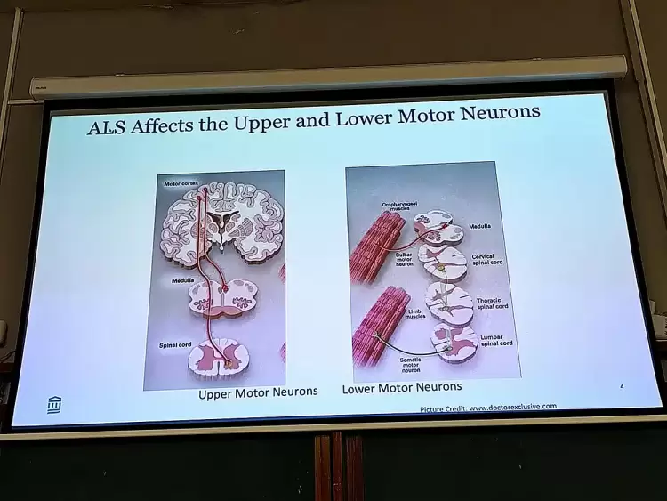 Σημαντική πρωτοβουλία για την Πλάγια Αμυοτροφική Σκλήρυνση (als) από την οικογένεια Τζίκα της με κορυφαίους επιστήμονες από την Ελλάδα και το εξωτερικό