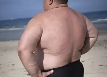 Παχυσαρκία: Η λάθος αντίληψη των Ελλήνων για τα παραπανίσια κιλά Παχυσαρκία: Η λάθος αντίληψη των Ελλήνων για τα παραπανίσια κιλά