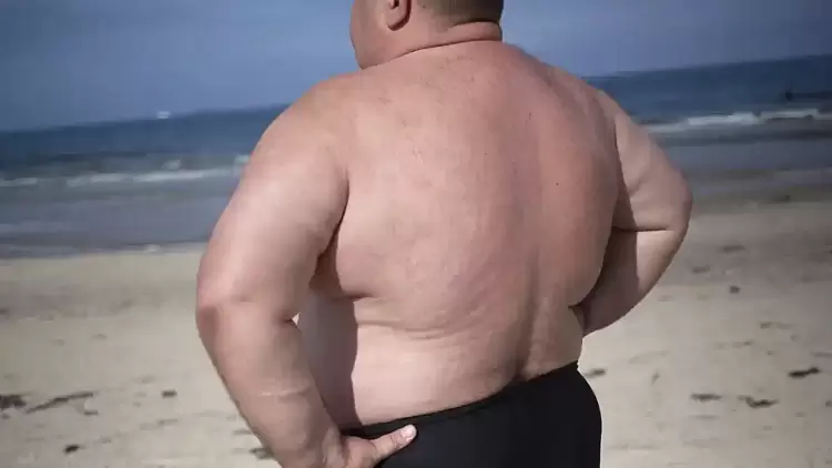 Παχυσαρκία: Η λάθος αντίληψη των Ελλήνων για τα παραπανίσια κιλά